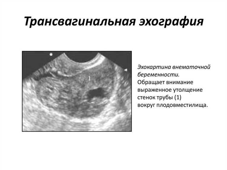 Влияние