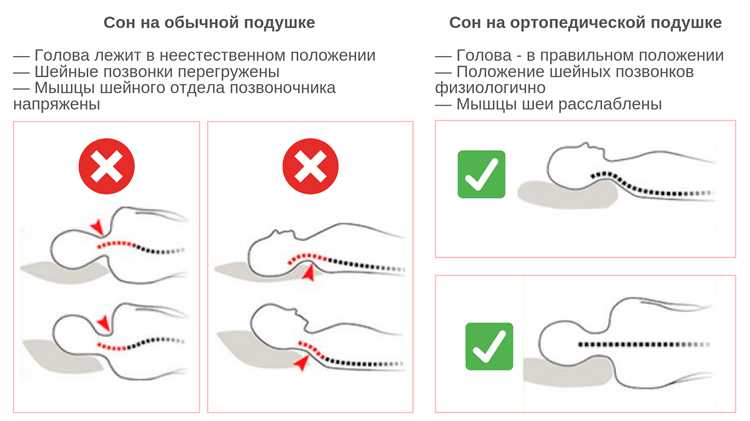 Преимущества