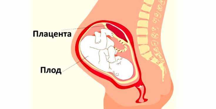 Заболевания,