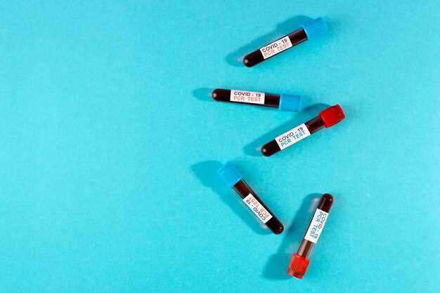 Совмещение анализа на ревматоидный фактор с другими исследованиями для подтверждения болезни