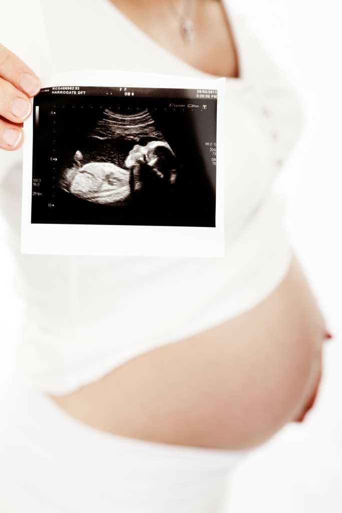 Определение срока беременности и визит к врачу