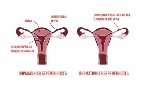 Особенности